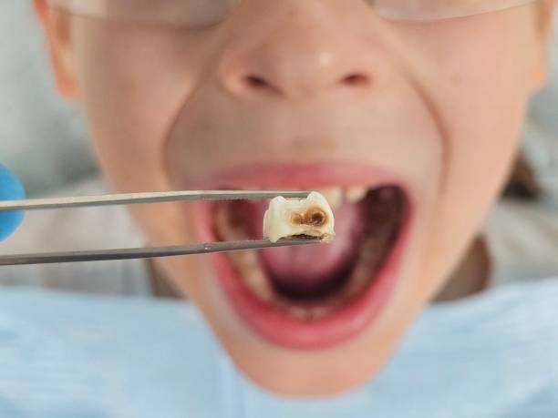 Best Emergency Dental Services for Seniors in Villisca, IA
